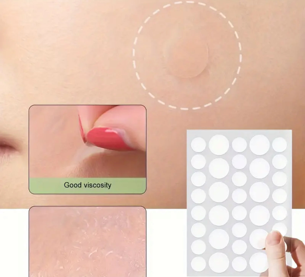 360pcs Invisible Acne Cover Up Stickers, For Covering Acne And Blemishes, Spot Stickers For Face And Skin